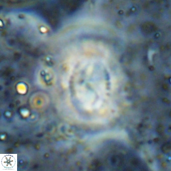 Watznaueria leesiae VR 21491