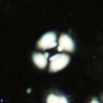 Watznaueria martelae 16209