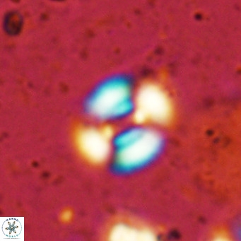 Watznaueria martelae 16210