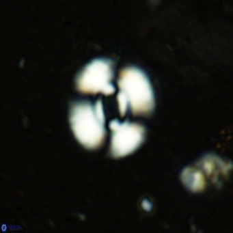 Watznaueria martelae 16213