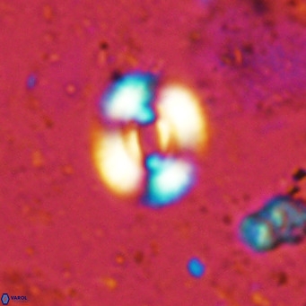 Watznaueria martelae 16214