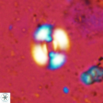 Watznaueria martelae 16214
