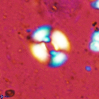 Watznaueria martelae 16215