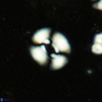 Watznaueria martelae 16216