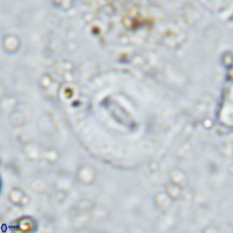 Watznaueria martelae 16218