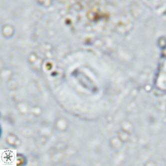 Watznaueria martelae 16218