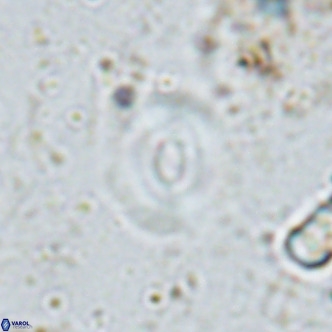 Watznaueria martelae 16219