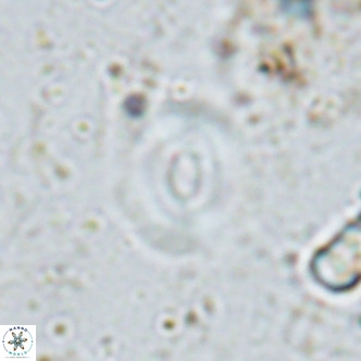 Watznaueria martelae 16219