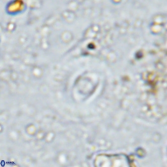 Watznaueria martelae 16220