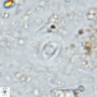 Watznaueria martelae 16220