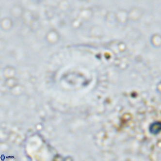 Watznaueria martelae 16222