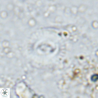 Watznaueria martelae 16222