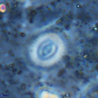 Watznaueria martelae 16224