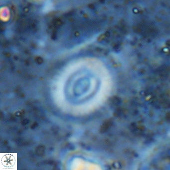 Watznaueria martelae 16224
