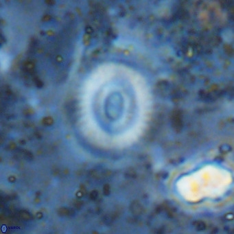 Watznaueria martelae 16226