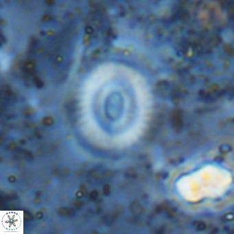 Watznaueria martelae 16226