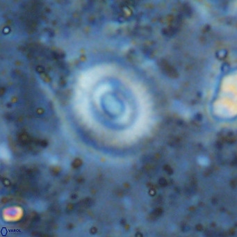 Watznaueria martelae 16227
