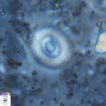 Watznaueria martelae 16227