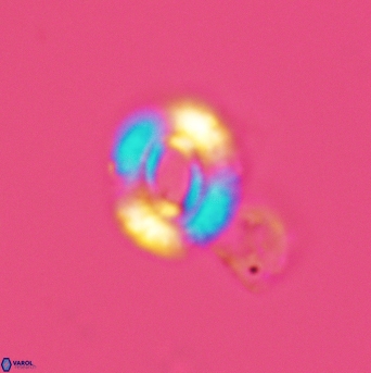Watznaueria martelae 3450