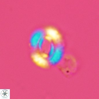 Watznaueria martelae 3450