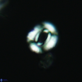 Watznaueria martelae 3452