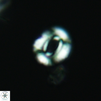 Watznaueria martelae 3452