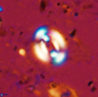 Watznaueria martelae 38942