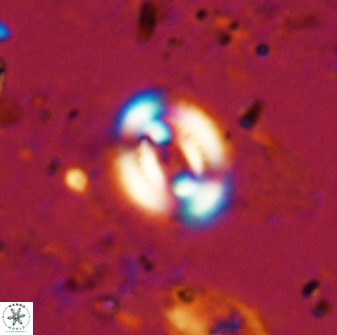 Watznaueria martelae 38942