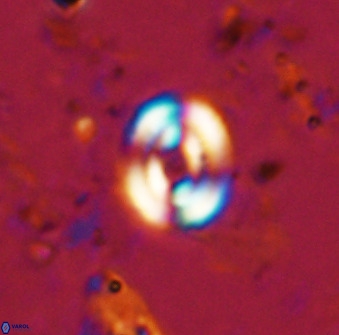 Watznaueria martelae 38943