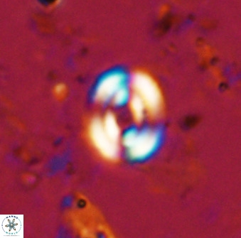 Watznaueria martelae 38943