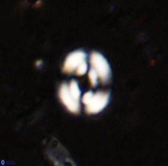 Watznaueria martelae 38944