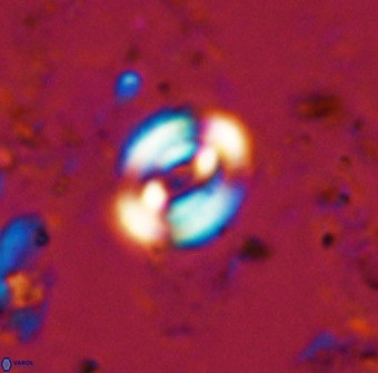 Watznaueria martelae 38946