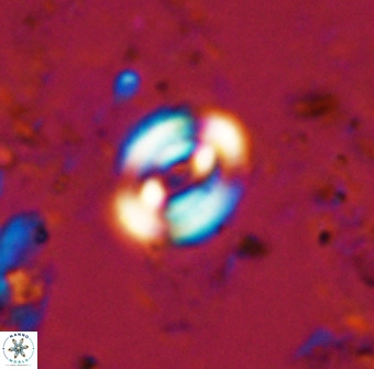 Watznaueria martelae 38946