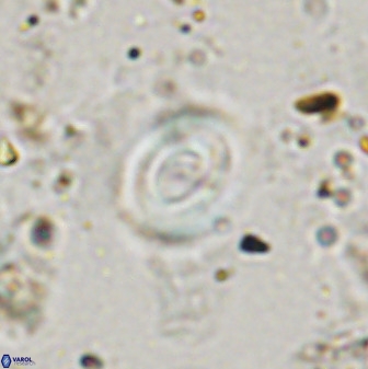 Watznaueria martelae 38950