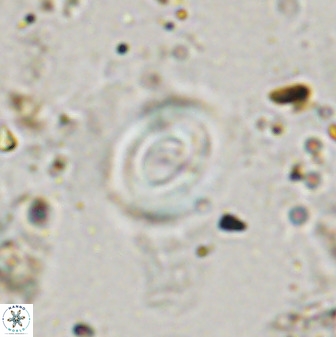 Watznaueria martelae 38950