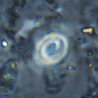 Watznaueria martelae 38951
