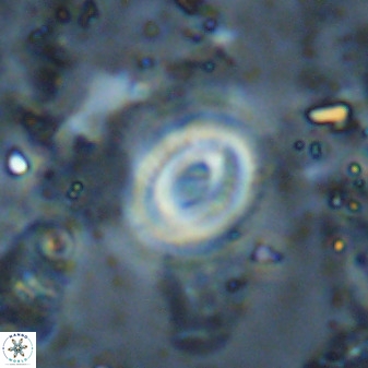 Watznaueria martelae 38951