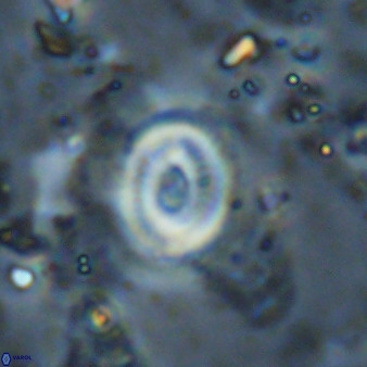 Watznaueria martelae 38952