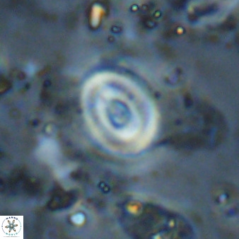 Watznaueria martelae 38953
