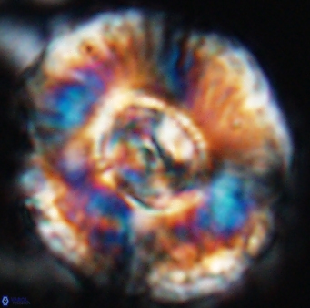 Watznaueria moshkovitzii 11003