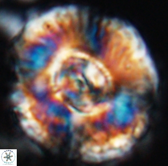 Watznaueria moshkovitzii 11003