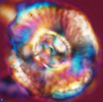 Watznaueria moshkovitzii 11004