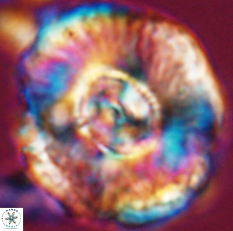 Watznaueria moshkovitzii 11004