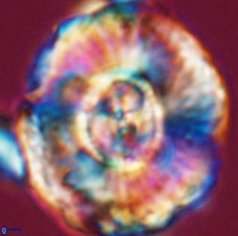 Watznaueria moshkovitzii 11005