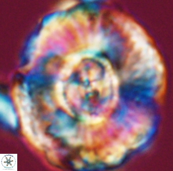 Watznaueria moshkovitzii 11005