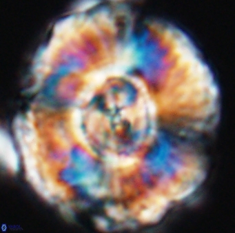 Watznaueria moshkovitzii 11006