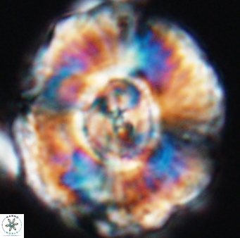 Watznaueria moshkovitzii 11006