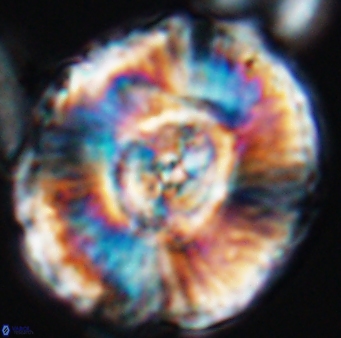 Watznaueria moshkovitzii 11007