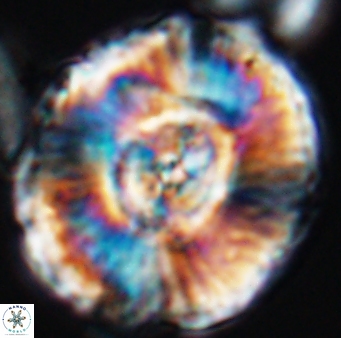 Watznaueria moshkovitzii 11007