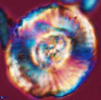 Watznaueria moshkovitzii 11008